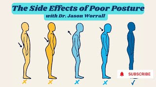Jason Worrall, DC, The Side Effects of Poor Posture!
