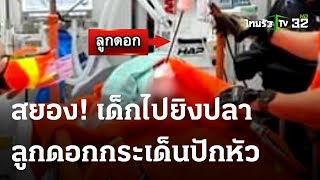 ด.ช.14ปี หาปลา พลาดถูกลูกดอกยิงแสกหน้า | 20 พ.ย. 66 | ข่าวเย็นไทยรัฐ