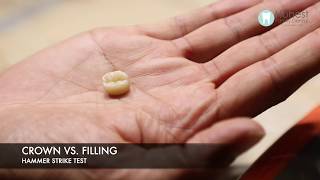 Crown vs. Filling - Hammer Strike Test