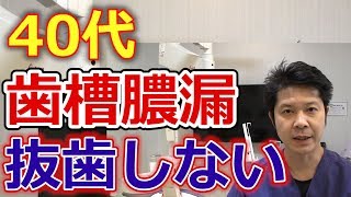 40代の歯槽膿漏で抜歯しなくても良い状態とは？【千葉市中央区の歯医者】