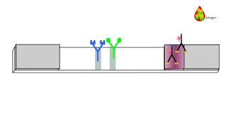 Principle of an antigen detection rapid diagnostic test (including prozone and backflow effect)