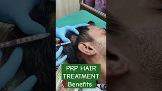 Prp hair treatment Benefits #beauty #prphairtreatment #ytshorts @delhiskincentre