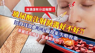 【雲說美學】玻尿酸注射淚溝好不好?!廷得耳效應/毛毛蟲現象/失明/栓塞