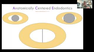 CE Webinar: Anatomically Centered Endodontics with Dr. Chafic Safi