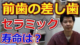 前歯の差し歯でセラミックを考えているのですが寿命はどれくらいですか？【千葉市中央区の歯医者】