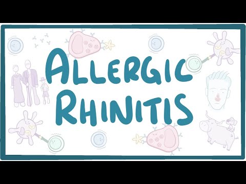 Is rhinitis an allergy?
