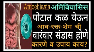 Amoebiasis-अमिबियासिस.पोटात कळ येऊन आव-रक्त-शेमची संडास होणे.कारणे व उपाय काय?|395|@drramjawale