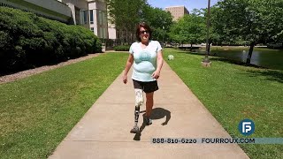 Above Knee Amputee Walks Pain Free with Care She Gets from Fourroux Prosthetics