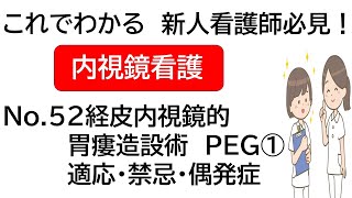 これでわかる　新人看護師必見！　内視鏡看護　介助No.52 経皮内視鏡的胃瘻造設術　PEG①　適応・禁忌・偶発症