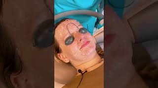 She LOVED The Trinity Laser (IPL + Sublime + Sublative) !