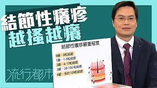 流行都市｜結節性癢疹 越搔越癢！｜結節性癢疹｜痕癢｜皮膚病