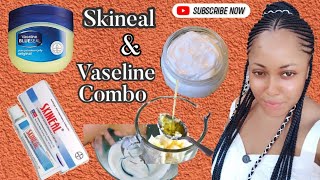 How To Safely Use Skineal \u0026 Vaseline To Brighten And Moisturize Your Skin This Harmattan Season..