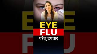 आई फ्लू से बचाव | Eye flu Prevention