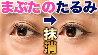 [Old face] For those who really want to remove the slack in their eyelids! 