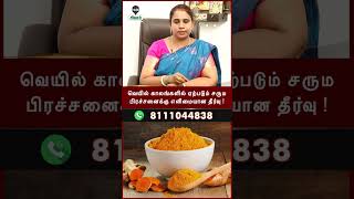 சரும பிரச்சனைக்கு  தப்பிக்க இதுதான் ஒரே வழி ! பயங்கர தாக்கத்தை ஏற்படுத்தப்போகும் வெயில் காலம் !