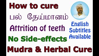 Fingers as doctor - Key To Cure (Attrition of teeth - பல் தேய்மானம்)