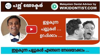 ഇളകുന്ന പല്ലുകൾ എങ്ങനെ നേരെയാക്കാം.. /മലയാളം Mobile/ loose teeth Dental Videos/Dr.Thomas Nechupadam