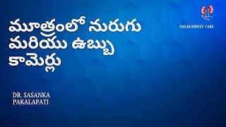 మూత్రంలో నురుగు మరియు ఉబ్బు కామెర్లు