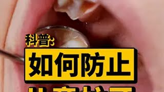 为什么孩子比大人更容易长蛀牙？看完后惊出我一身冷汗！科普  蛀牙  兔头妈妈儿童牙膏  新年有意思