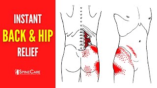 How to Fix Hip and Back Pain on One Side
