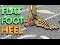 Landing on your Heel will make your Flat Feet worse (How to Walk)