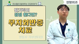 [닥터스발가락이 점점 휜다면? 무지외반증 치료 l 정동우 족부센터장 l 구포성심병원 l  051)333-2001