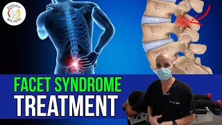 Facet Syndrome Treatment {Synergy Wellness Chiropractic & Physical Therapy}
