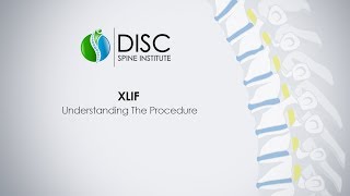 XLIF Understanding The Procedure