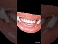 பல் வலிக்கு அக்குபஞ்சர் புள்ளி acupressure toothache acu dr sumathi