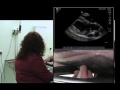 imv imaging cardiac ultrasound video 5 right parasternal long axis 5 chamber view