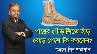 গোঁড়ালি ব্যথা/ heel pain/ Heel Spur treatment in Bengali