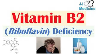 Vitamin B2 (Riboflavin) Deficiency | Food Sources, Causes, Symptoms, Diagnosis and Treatment