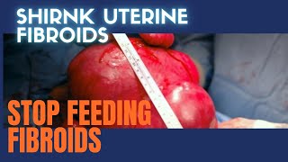 How to Shrink Uterine Fibroids Naturally