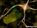 neuronal degeneration 3d