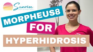 Morpheus8 for Hyperhidrosis
