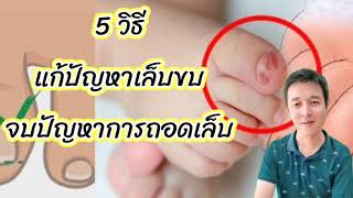 5วิธีแก้ปัญหาเล็บขบ จบปัญหาการถอดเล็บ