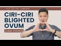 Ciri-Ciri Hamil Kosong / Blighted Ovum #DokterNicoMenjawab