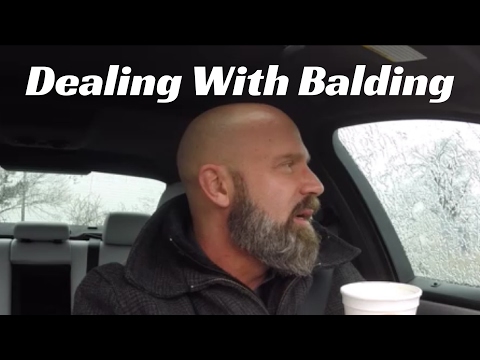 How To Accept Losing Your Hair as a Man How To Accept Losing Your Hair as a Man