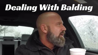 How To Deal With Balding