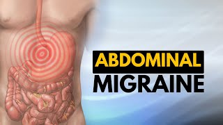 Abdominal Migraine, Causes, Signs and Symptoms, Diagnosis and Treatment