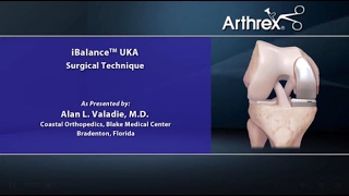 iBalance® UKA Surgical Technique