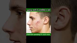 अगर आपके चेहरे पर pimple हैं तो ये 3 चीजें face पर कभी मत लगाना🙏🙏 #shorts #shortvideo#pimpleproblem