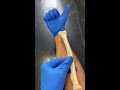 ulna