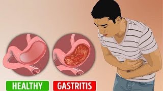 Gastritis: Stomach Inflammation Diet, Symptoms & Cure | HealthCare.