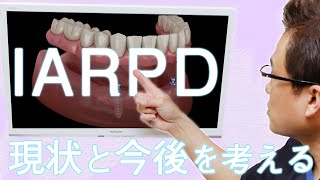 【IARPD】臨床成績と付き合い方の基礎（歯科論文を考察）