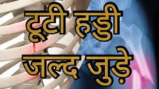 bone health//टूटी हड्डी जल्दी जुड़े