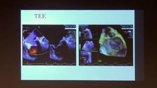 Illustrative Case Presentations #2 | 2017 UCLA ACHD Symposium