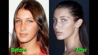 Cerny surgery amanda plastic Amanda Cerny