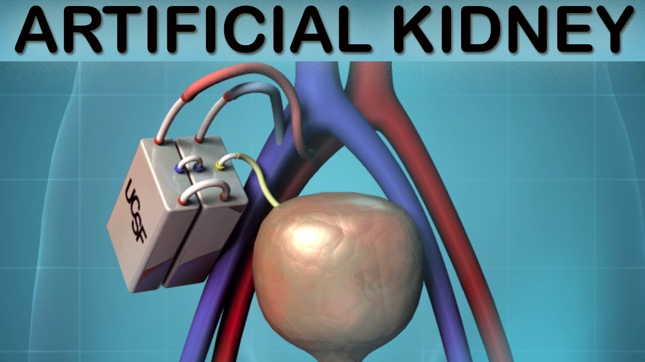 Kidneys, Artificial