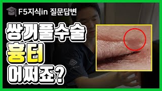 [🎓F5지식in] 쌍수했는데 흉터가 남았다구요? | 쌍수 절개흉터 관리, 제거